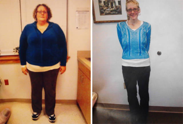weight loss success stories 99 pics 9.html - 99 HD Photos | Premium Gallery 2016