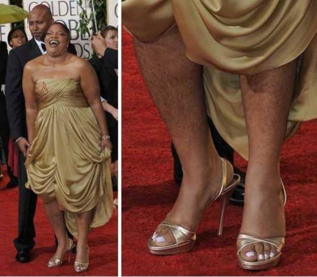 Celebrities Wish No One Saw These Embarrassing Pictures