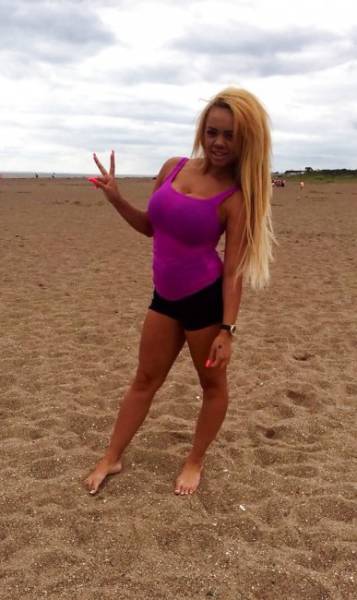 Your Face Can Look Like This If You Do Lots Of Lip Injections