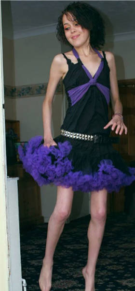 A Former Anorexic Is Proud Of Her Stomach Rolls