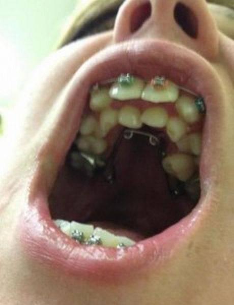 daily picdump 93 pics 36.html - 93 HD Photos | Premium Gallery 2016